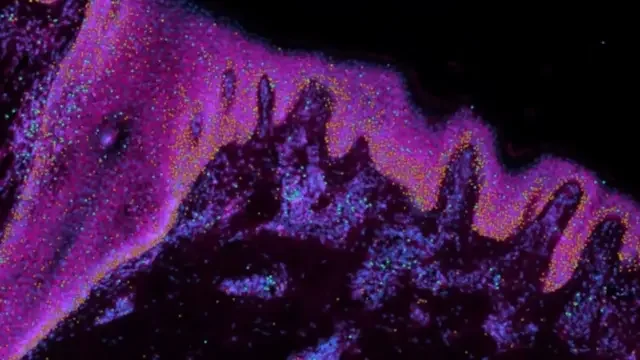 Флуоресцентное микроскопическое изображение повреждённых спекой клеток ДНК