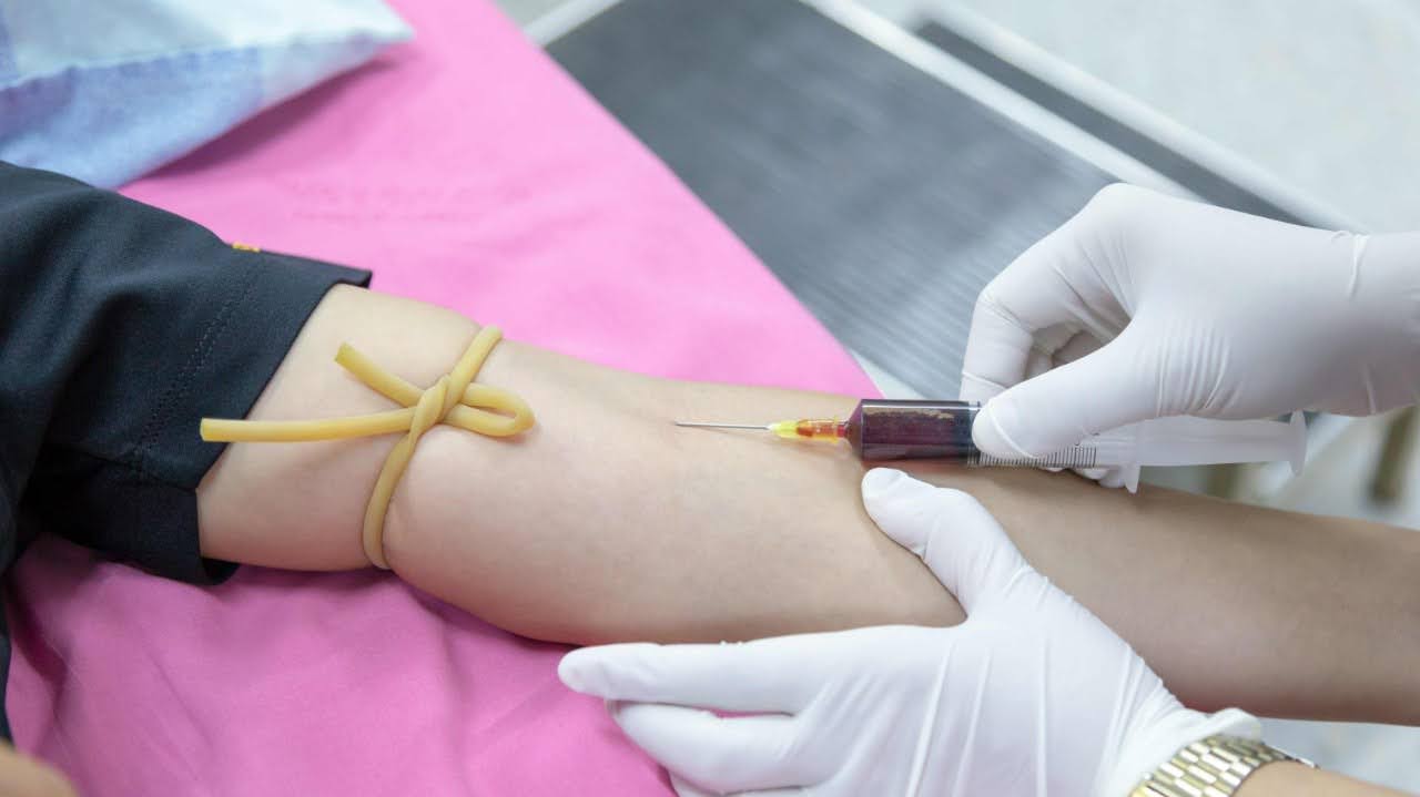 Консультація гематолога коли потрібно звернутися